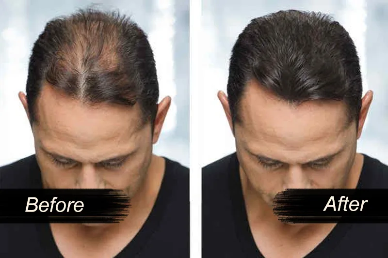 Hair Gluing