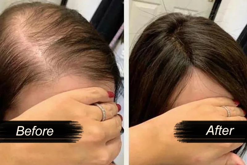 Hair Wig