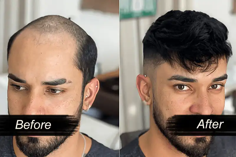 Hair Wig